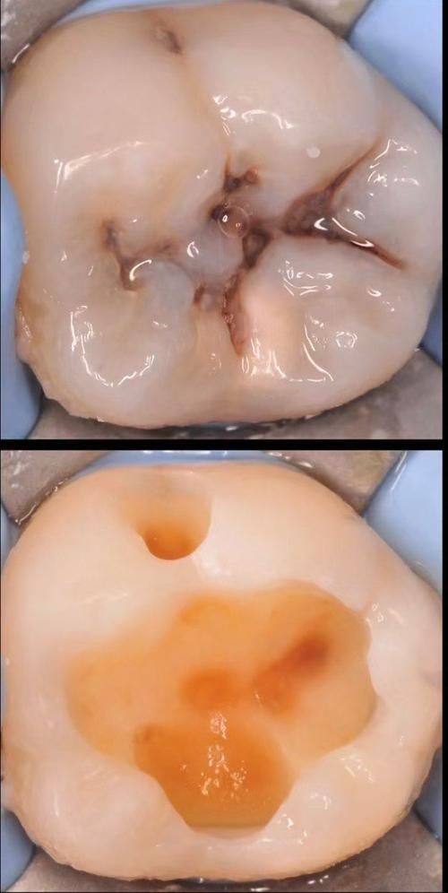 云南大理诚康口腔连锁地址电话及营业时间