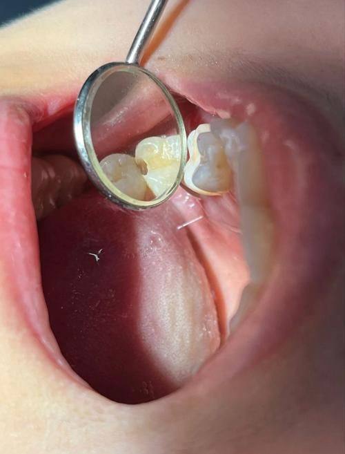 保定灿若悦芽口腔门诊口碑评价: