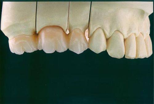 武侯曼斯特口腔门诊部擅长项目：