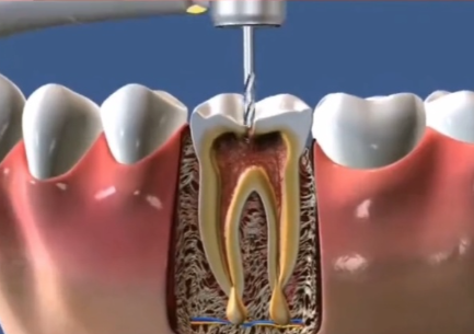 泰州福因口腔(万象城店)擅长项目: