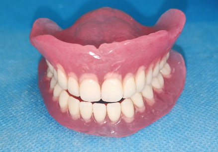 五、牙神经治疗的重要提醒