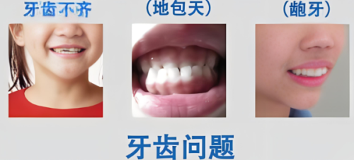 四、威兰德全瓷牙真假辨别实用方法，避坑必看