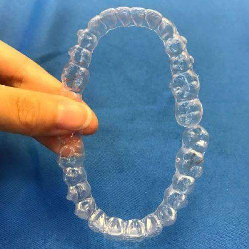 种烤瓷牙和全瓷牙有什么区别？7大核心维度对比+适配人群全梳理指南