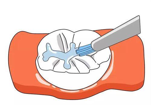 浙江宁波萌芽口腔地址电话及营业时间：