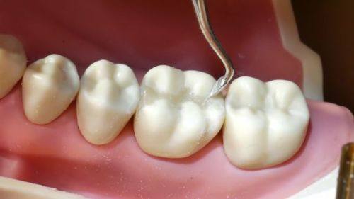 惠州博罗惠康口腔预约挂号方式