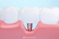 惠州博罗惠康口腔擅长项目：