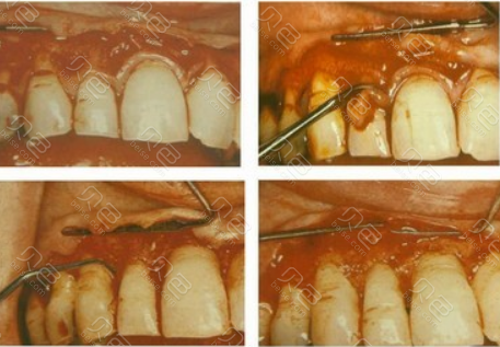 遵义市红花岗金科口腔擅长项目:
