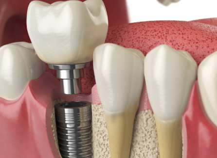 七、适配人群：性价比之选vs美学与敏感人群优选
