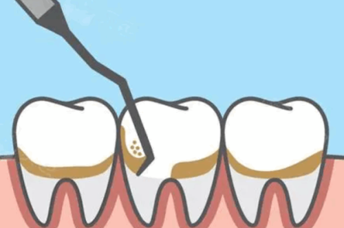 二、多地补牙镶牙医疗保险政策具体解析
