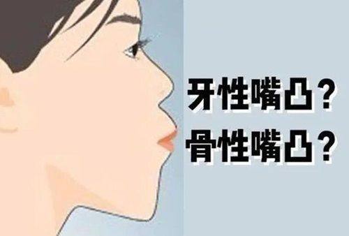 二、没有牙结石洗牙的核心意义:预防大于治疗