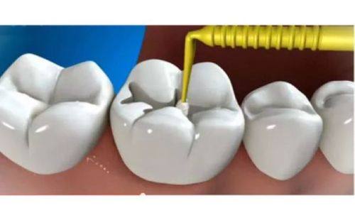 东莞虎门镇口丽阳口腔门诊部预约挂号方式