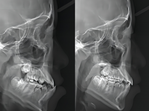 三、完整流程里的关键细分环节