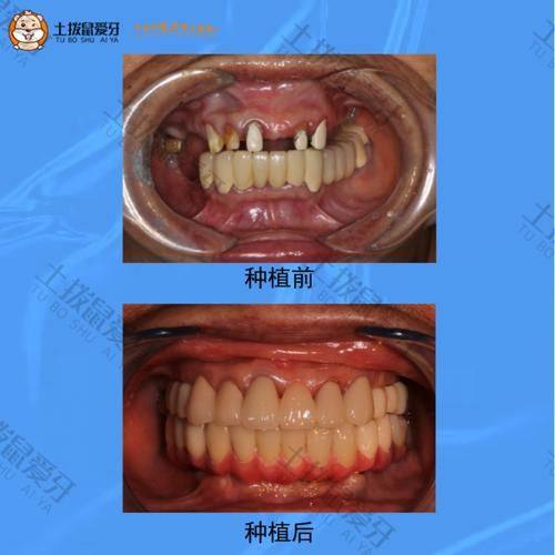 山西忻州许晓军口腔地址电话及营业时间：