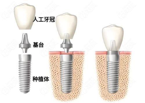 梁腾医生口碑评价