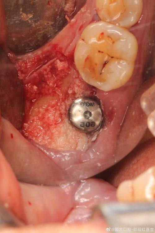 吴泽宇医生口碑评价