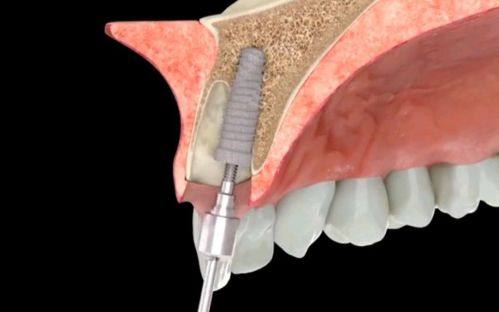 金礼彬医生怎么预约
