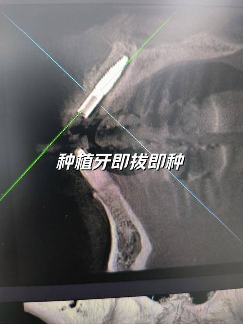 吴泽宇医生技术优势