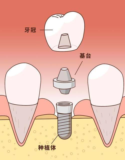 金礼彬医生擅长领域: