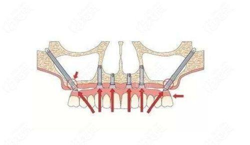 曾堃医生怎么预约