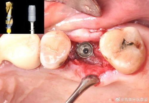 吴思远医生口碑评价