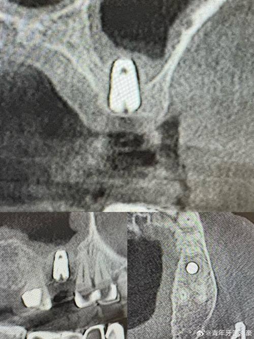 吴思远医生技术优势