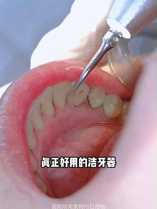 重庆明好医院口腔口碑评价：