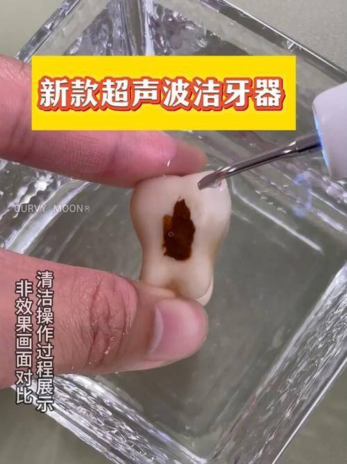 重庆明好医院口腔预约挂号方式：