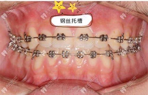 济南历城万洁口腔诊所擅长项目