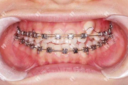 宋磊医生擅长领域