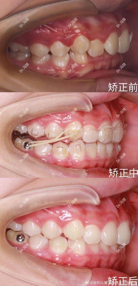 王创医生怎么预约