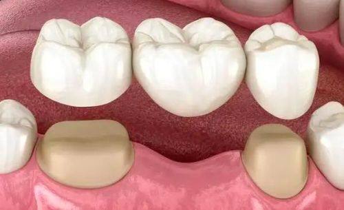 湘雅常德医院口腔科价格表：