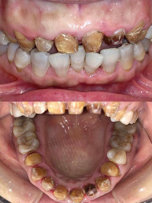 曾堃医生口碑评价