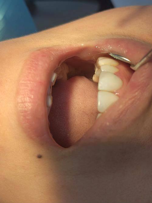 石家庄科瓦口腔诊所擅长项目: