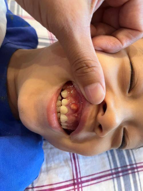 张娜医生口碑评价