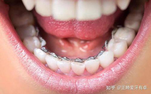 杨春犁医生技术优势