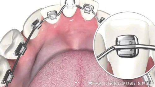 杨春犁医生擅长领域