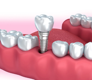 三、真性地包天：轻度有自愈可能，重度需警惕