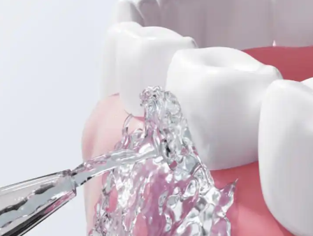 二、拔牙后吃阿胶糕的关键注意事项