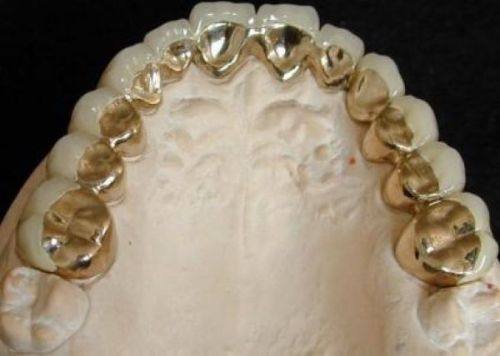 云南曲靖宣威市爱牙仕口腔口碑评价: