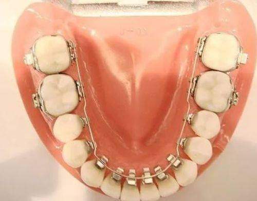 牙龈炎发作时的拔牙禁忌明细