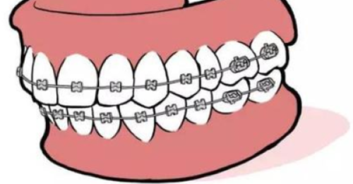 五、不同需求的种牙选择建议