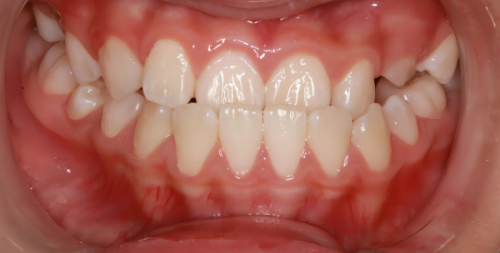 三、高性价比种植牙机构怎么挑