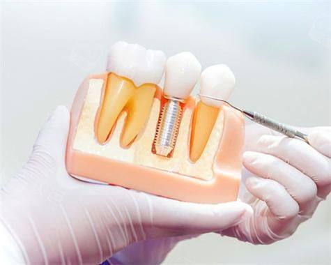 湖北宜昌艾雅口腔预约挂号方式：