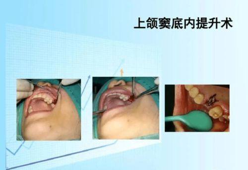 高夏玲医生怎么预约