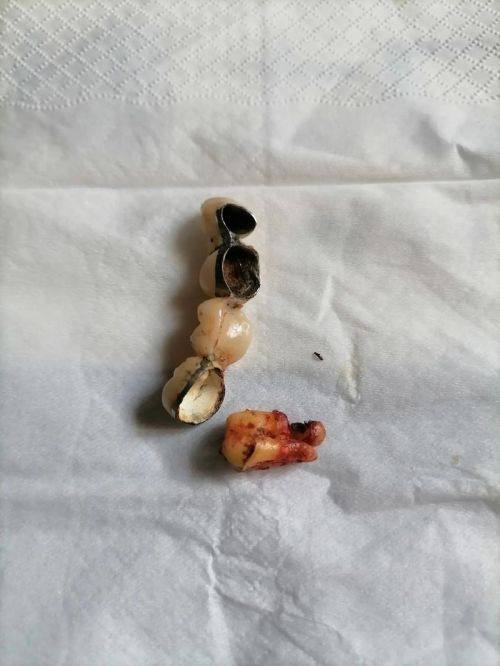 鲁利花医生技术优势