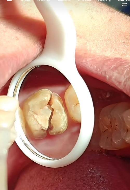 郑州精益口腔(天明路分院)擅长项目: