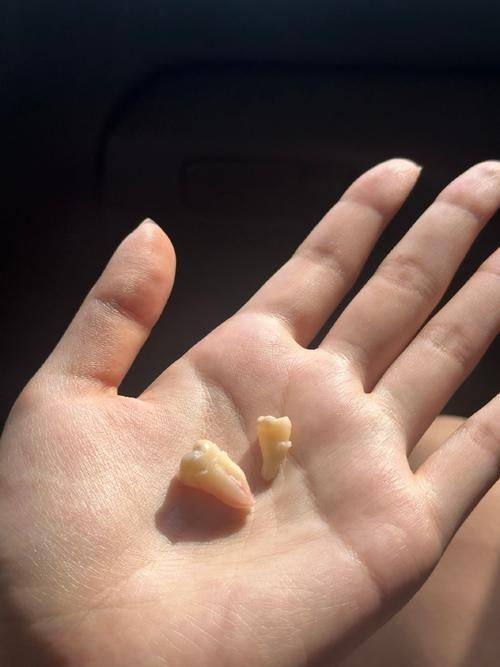 呼伦贝尔市人民医院口腔颌面外科擅长项目: