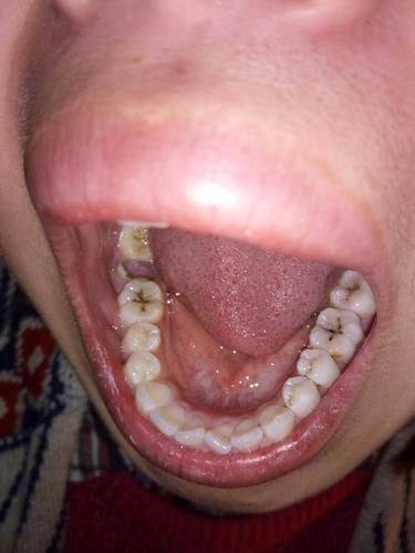 安徽医 科 大学附属阜阳医院口腔科怎么样