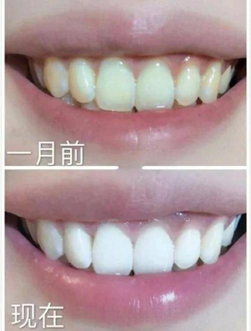 杨丽平医生怎么预约