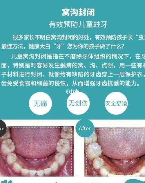 福州金福康口腔诊所预约挂号方式